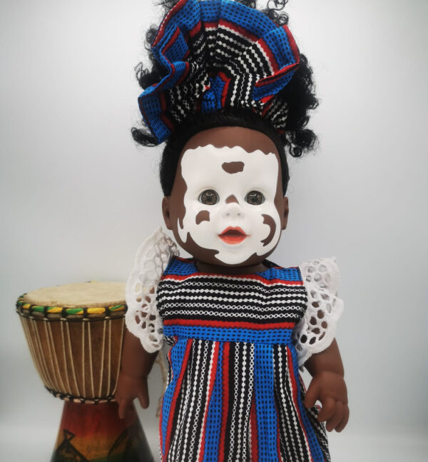 Poupée Winnie Kidunya Vitiligo